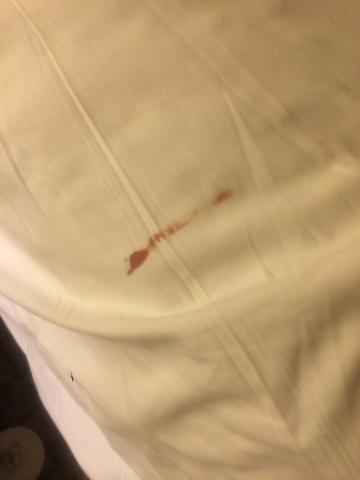 Blood? In A Hotel Room? Unpossible.