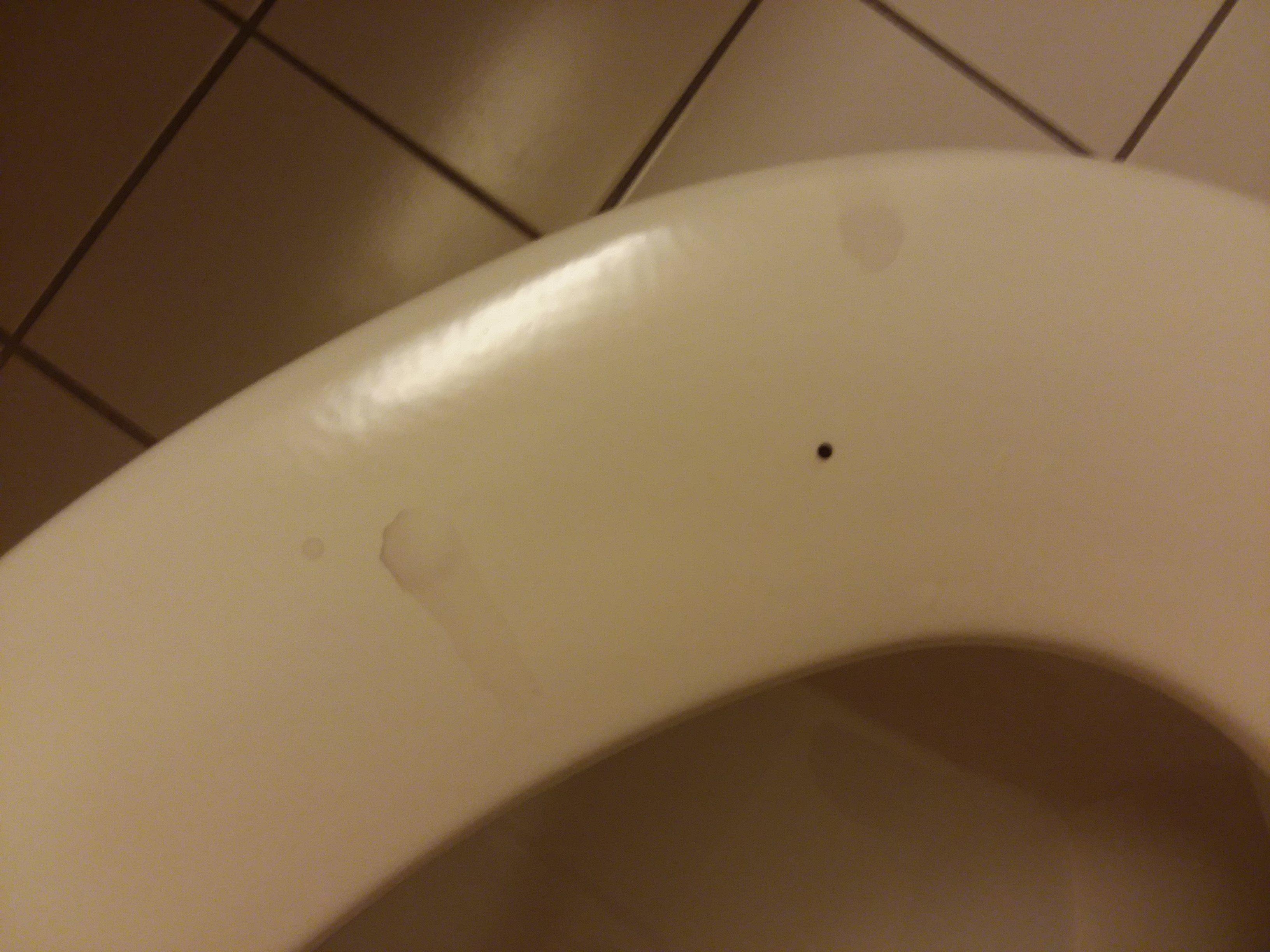 Toilet Seat Drippage